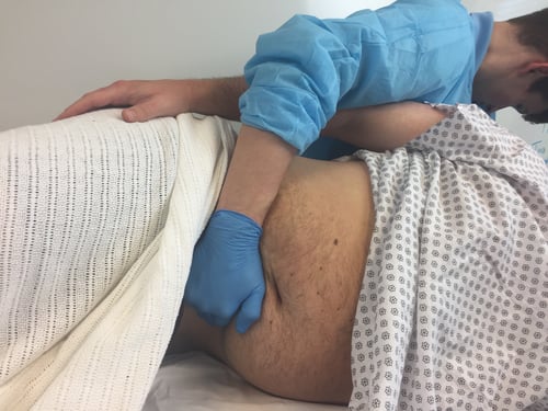 Risky patient handling during colonoscopy