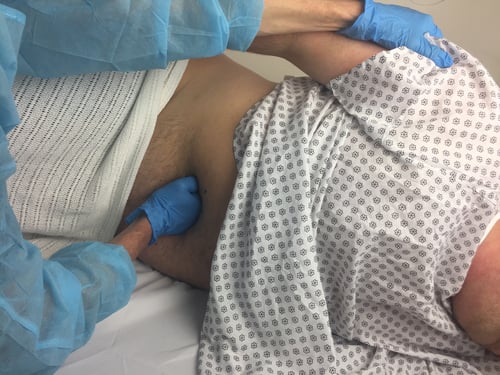 Endoscopy nurse applying abdominal pressure during colonoscopy