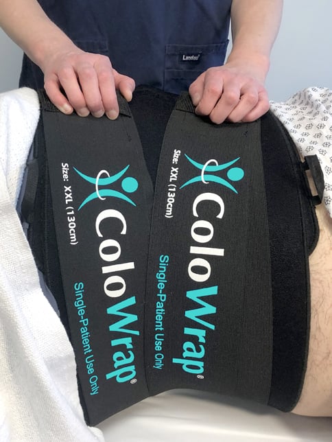 two-secondary-straps-on-patient