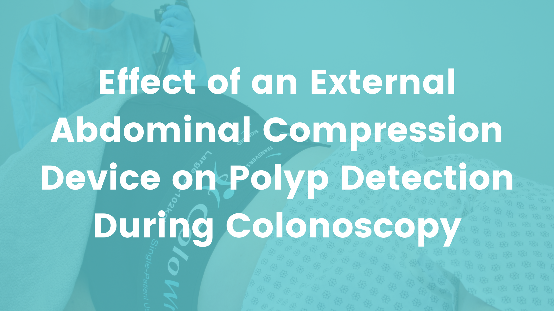 Effect of External Abdominal Compression Device on Polyp Detection During Colonoscopy